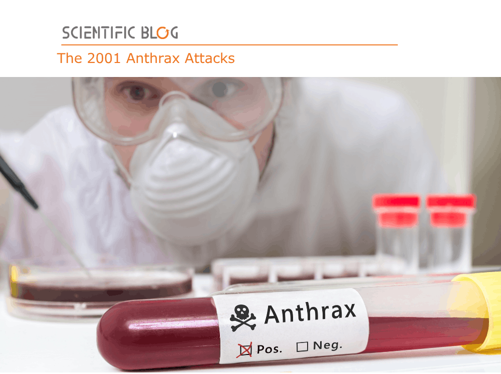 The 2001 anthrax attacks